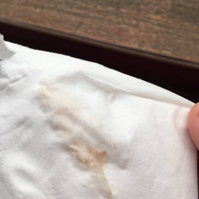 我怀孕40天，昨天去检查，医生让做了阴超，然后就发现下面有咖啡色的东西，怎么回事啊，_育儿问答_宝宝树