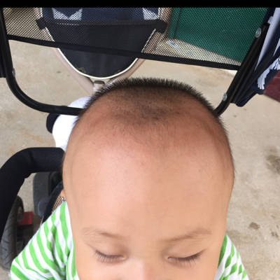 宝宝10个月 额头上边头骨比较突出 头顶还能明