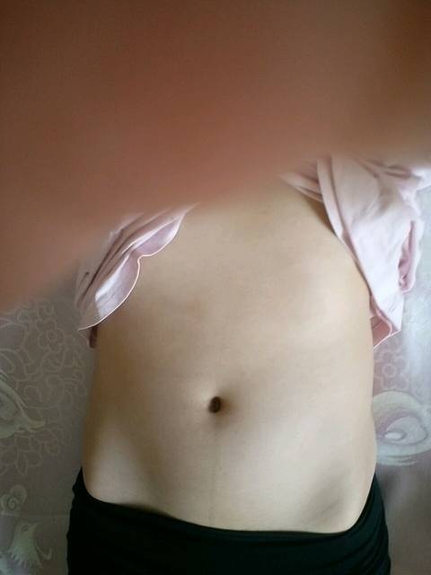 双角子宫已孕15周附图_有双角子宫怀孕的吗?