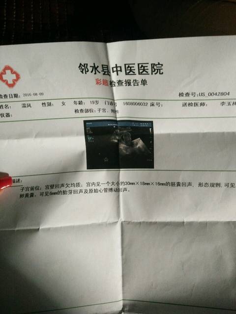 看男女_有没有有经验的孕妈帮我看下男女啊,第