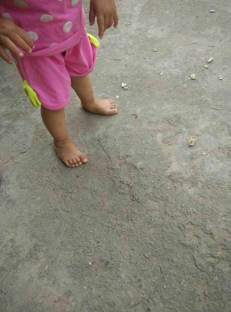 求助宝妈们_宝宝一岁一个多月刚学会走路,左脚