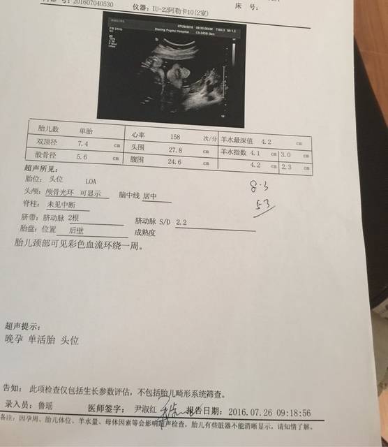 妇幼没有小排畸吗?_听别人说别的医院在29至