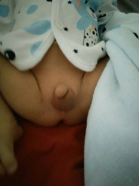 婴儿睾丸一边大一边小怎么回事_儿子的蛋蛋一