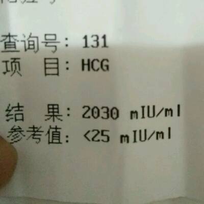 这个是下午抽血验孕化验单,有谁能看懂这个?这
