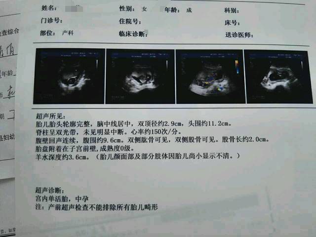 怀孕4个月刚才去当地妇幼,医生说胎儿
