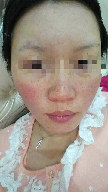 宝宝出生后缺氧怎么办?有类似的宝妈请问一下