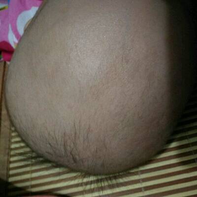 为什么我家宝宝六个月了头发还不长啊,四个月