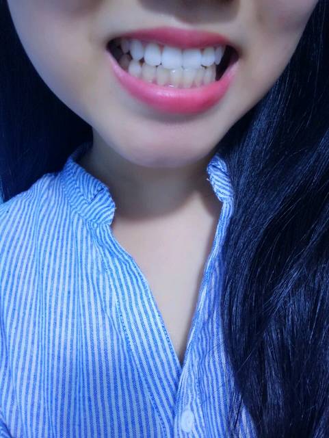 想要牙白来找我吧_炫方美牙仪,给你唇红齿白,健康冷光美白牙齿_宝宝树