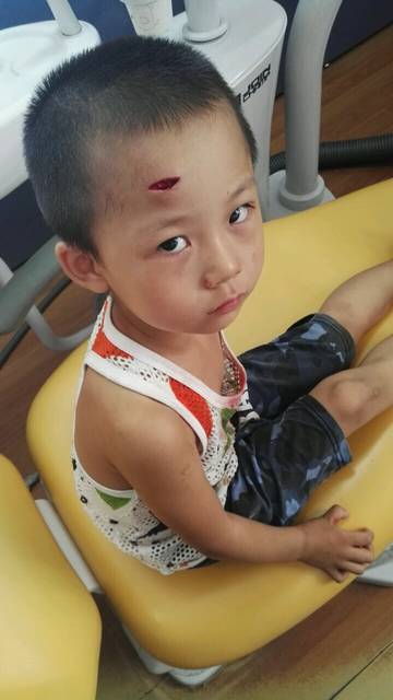 儿子在幼儿园把额头磕了一道三厘米的口子缝了