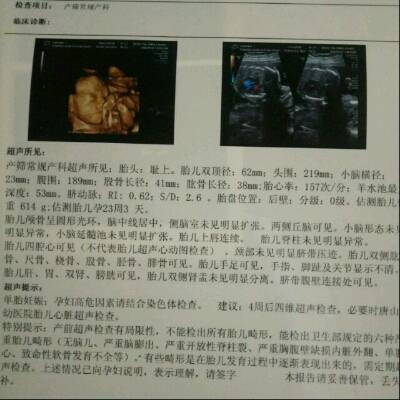 怀孕六个月了 胎动不是特别频繁 但是做产筛检