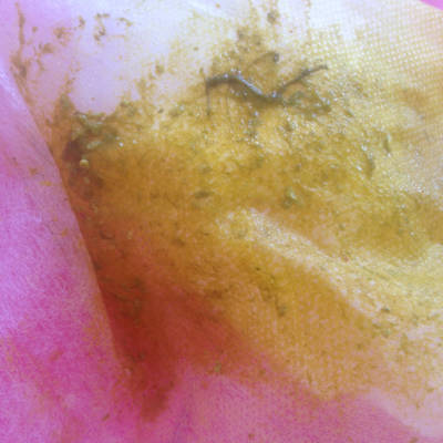 我家宝宝两个月零17天最近这几天拉这样的屎