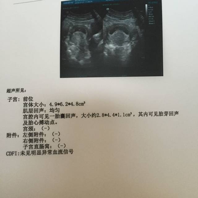 孕7周的彩超,大家帮我看看男宝女宝,谢谢啦