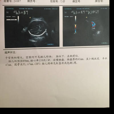 上面写着左枕前位是什麼意思呢