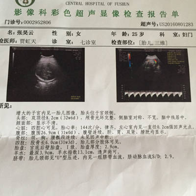 24周大排畸胎儿左心室强光点!32周三维彩超复