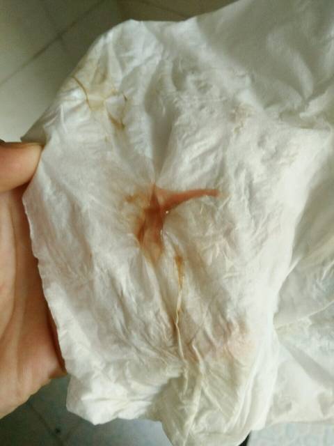 第二胎了!怀孕38+见红俩次正常么?_第二胎了