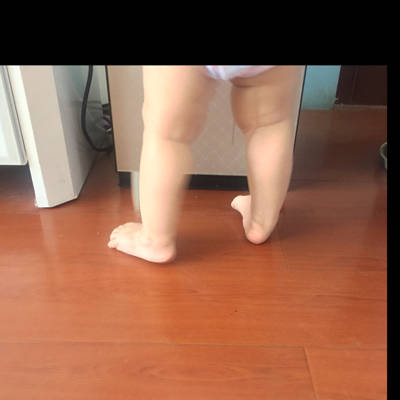 宝宝一周一个月,已经会走了,最近几天走路发现宝宝右脚老是这样走路