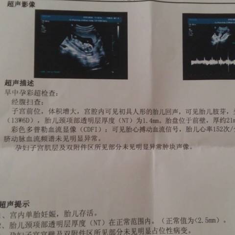 看男女,给我B超单子就好!_怀孕后每天都好奇自