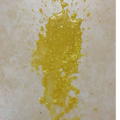 我家宝宝两个半月,现在拉肚子三天了,去医院医