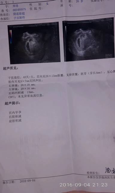 手足无措_末次月经7.26,9.3试纸检测怀孕,去医