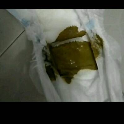 宝宝拉的便便有半个月了 这正常吗 别的正常 吃