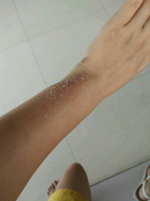 怀孕后脚痒_怀孕六个多月了。脚上开始痒的不