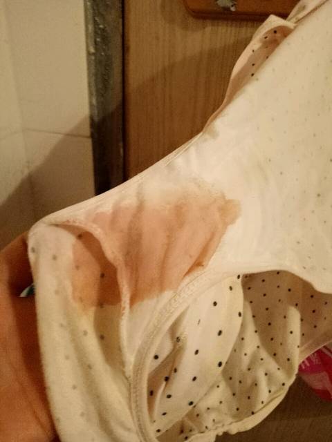 流褐色分泌物是临产前兆吗?_前天因为宫缩去