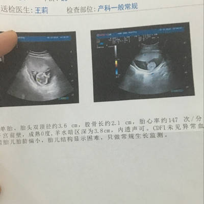 怀孕3个多月,胎儿双顶径约3.6com.股骨2.1com