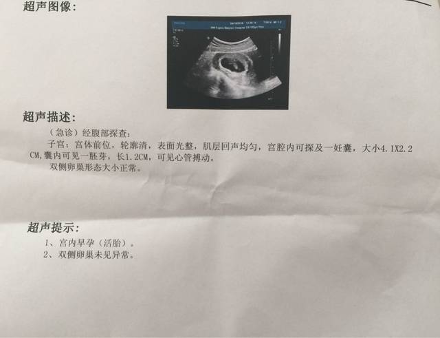 好激动,胎心胎芽都有了_孕7周+3,4周时持续褐色分泌物1周_宝宝树
