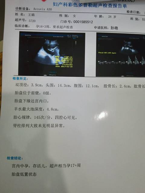 胎盘低置怎么办