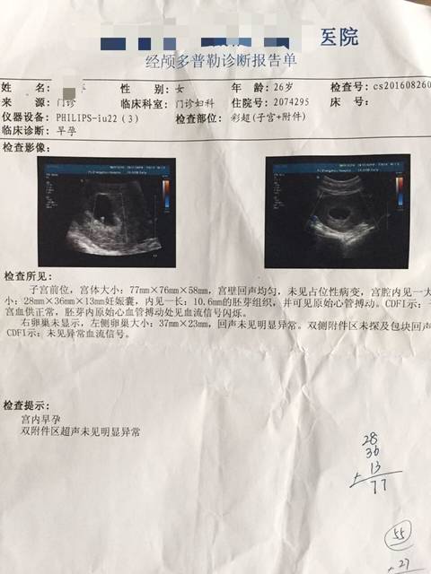 帮忙看女孩女生,7周多的B超单_哈,7周多的男孩巨蟹座彩超图片动漫图片