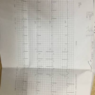 这是我今天去妇幼保健医院检查做的心电图,医