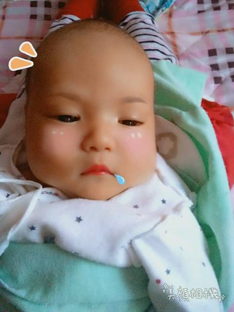 黄疸高_有没有宝妈知道怎么快速退黄疸。出生