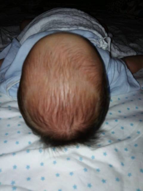头型问题宝宝_请宝妈们帮忙看一下我宝宝的头如何扎漂亮的高马尾图片