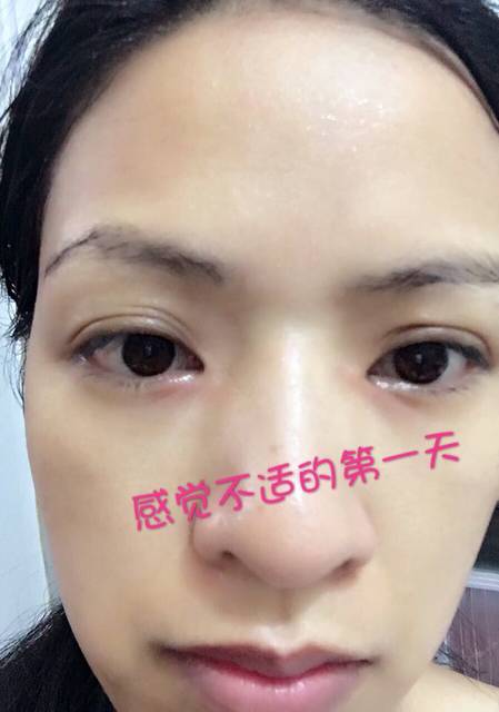 蜘蛛射尿,茶油好帮手