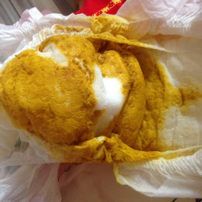 宝宝最近拉水,应该是从我吃了几个葡萄引起的