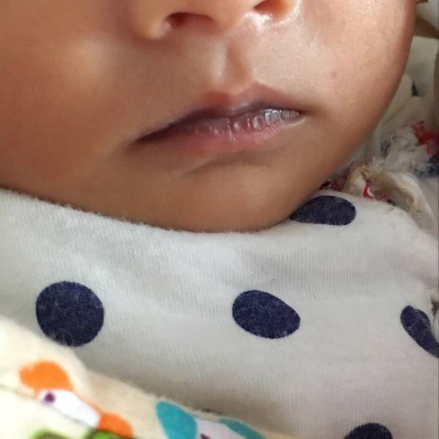 宝宝嘴唇内侧发紫,外侧正常