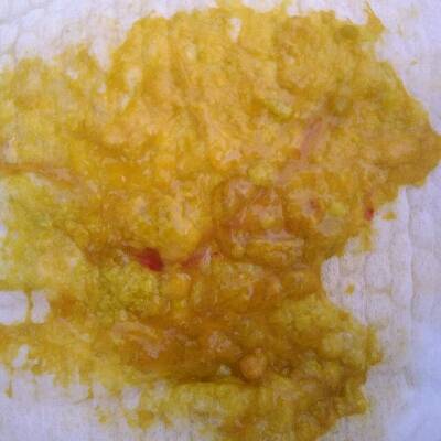 宝宝今天二十六天了,今天拉的便便有血,是怎么