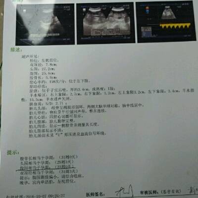 怀孕30周胎儿腹围值明明正常的,为什麼说相当於23周的