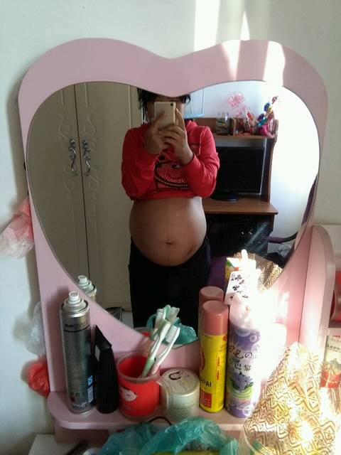 有没有准妈妈怀孕后期手肿的,而且发麻,连着胳