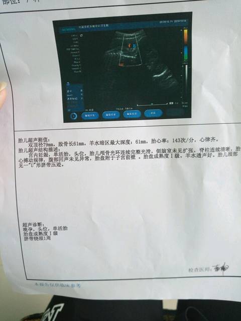 不知道怎么算胎儿体重