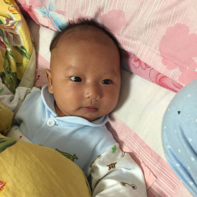 宝宝73天黄疸退去了,额头有些黑黄怎么办,什么