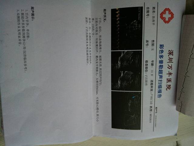 B超和NT同时做对胎儿没什么影响吧_B超和NT