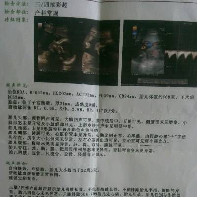 我今天照了四维彩超,胎儿左心室可见两个强光点,医生当时说胎儿有可能