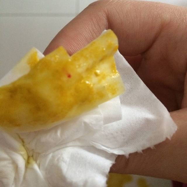 什么是纯母乳喂养_母乳喂养的正确方法是什么