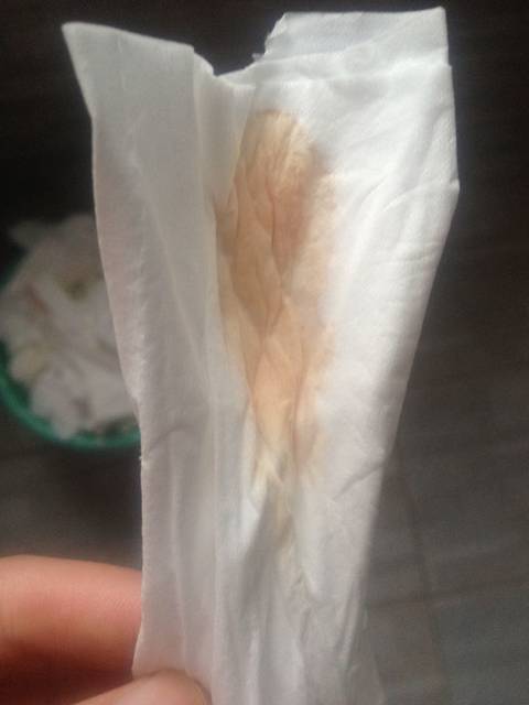 孕38周,宝妈们帮我看看这是见红吗?_孕38周,大