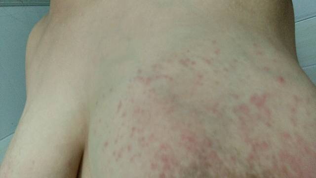 身上痒,求救_有没有哪位宝妈跟我一样的喂母乳