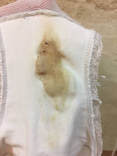 昨天咖啡色分泌物又来了,怎么办_昨天晚上发现