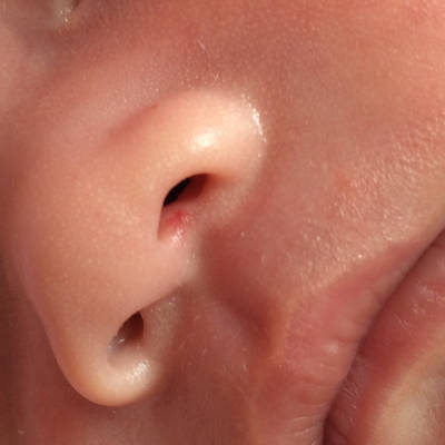 宝妈们帮忙看看我家宝宝鼻孔那里的那个红色的是怎么回事?有知道的吗?