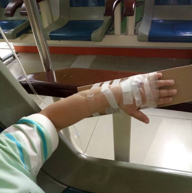 宝宝肺炎,打了两天的吊水的_大家知道什么是提