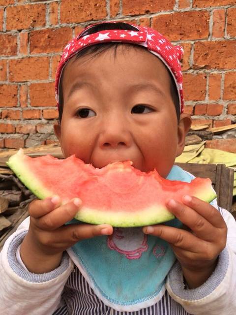 孩子摔了一跤,变成日本娃娃了_孩子昨天跑太快